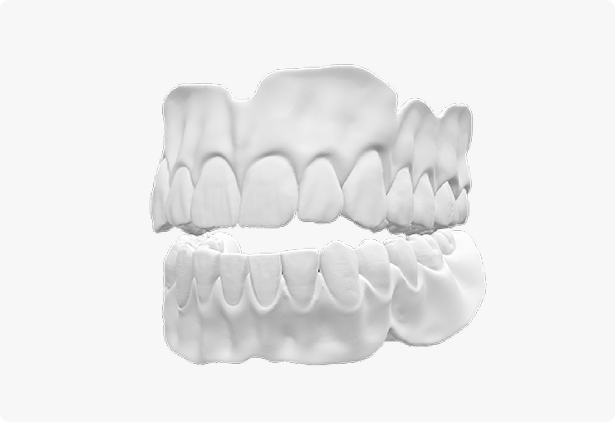 Denture